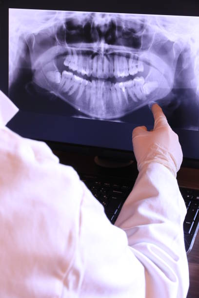 Best Emergency Dentist for Knocked-Out Tooth in Temperance, MI