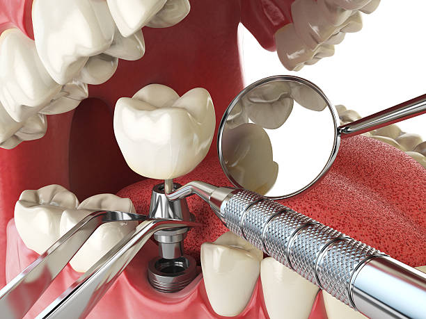 Best Emergency Dentist for Special Needs Patients in Temperance, MI